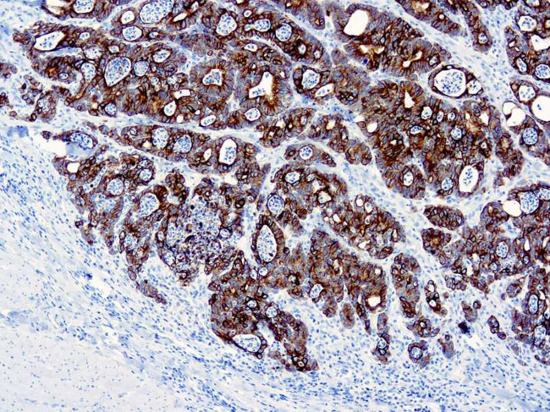Cytokeratin 19