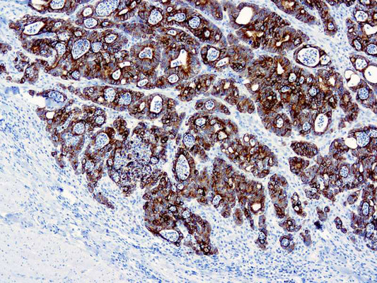 Cytokeratin 19
