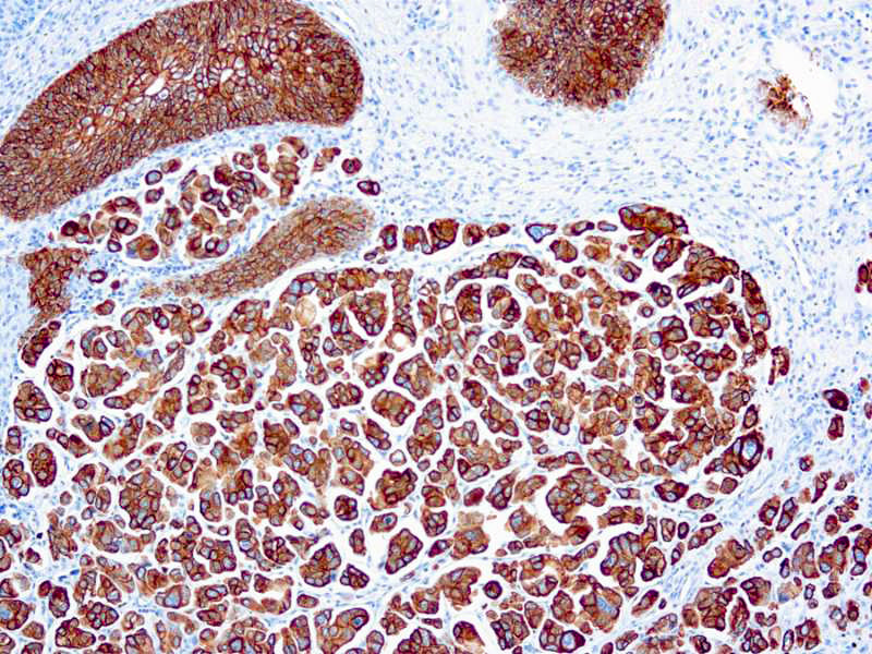 Cytokeratin 7