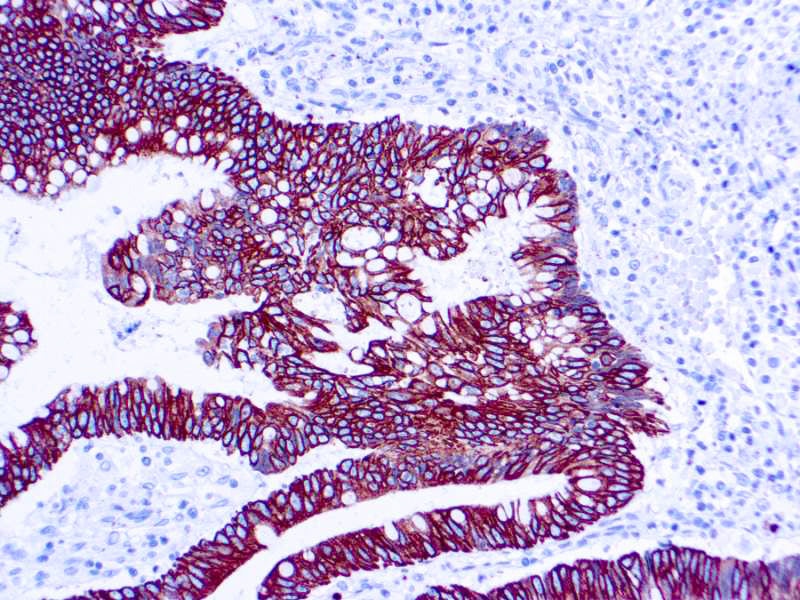 Cytokeratin 8/18