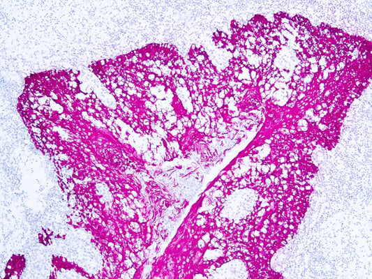 Cytokeratin H.M.W.