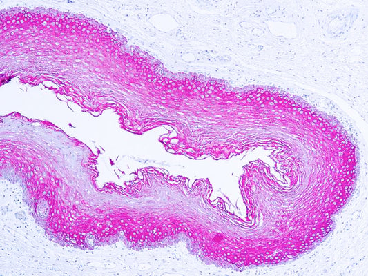 Cytokeratin Wide Spectrum