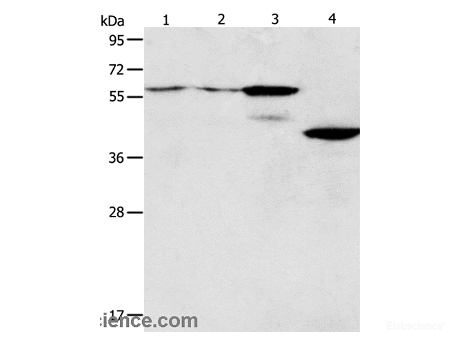 Western Blot analysis of A375 and A172 cell, Mouse pancreas tissue, Human liver cancer tissue using PGBD2 Polyclonal Antibody at dilution of 1:550