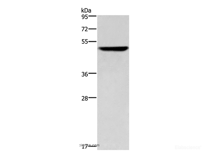 Western Blot analysis of Hela cell using CK-16 Polyclonal Antibody at dilution of 1:350