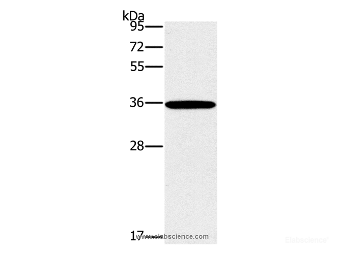 Western Blot analysis of 231 cell using FOSL1 Polyclonal Antibody at dilution of 1:615