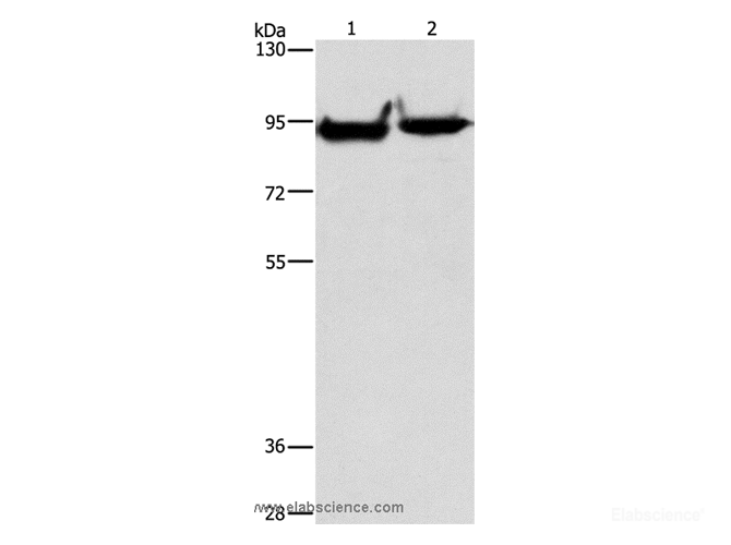 Western Blot analysis of Mouse heart and brain tissue using MARK1 Polyclonal Antibody at dilution of 1:500