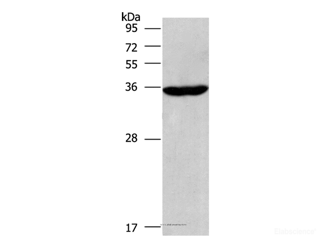 Western Blot analysis of Raji cell using CIAPIN1 Polyclonal Antibody at dilution of 1:597