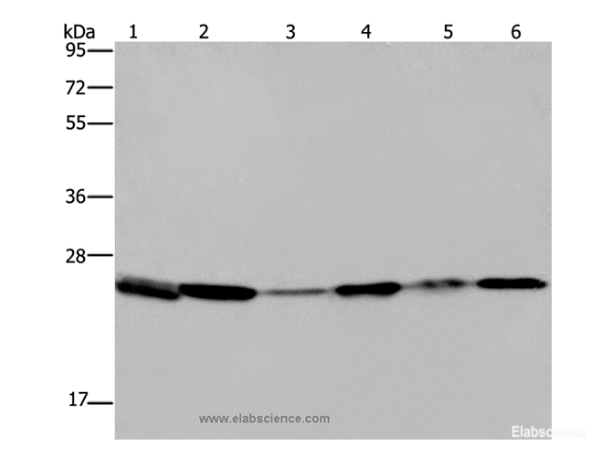 Western Blot analysis of Mouse spleen tissue, A375, A549 and HT-29 cell, Mouse lung and Hela cell using ARHGDIA Polyclonal Antibody at dilution of 1:400