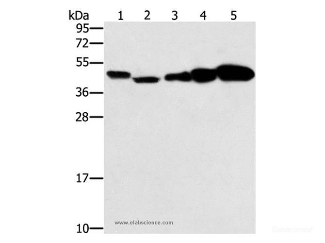 Western Blot analysis of Hela, Raji, Jurkat, A549 and NIH/3T3 cell using PPAT Polyclonal Antibody at dilution of 1:250