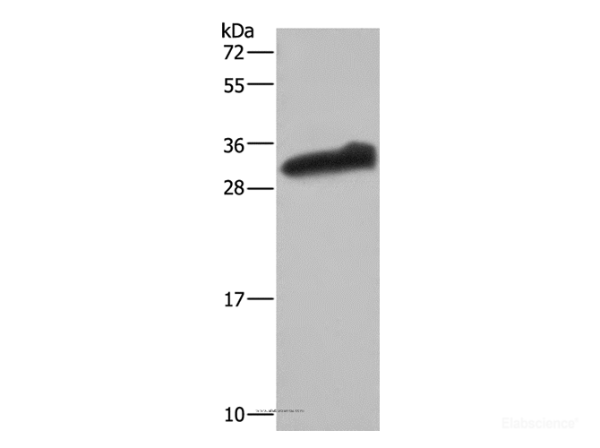 Western Blot analysis of Human testis tissue using GSTA3 Polyclonal Antibody at dilution of 1:250