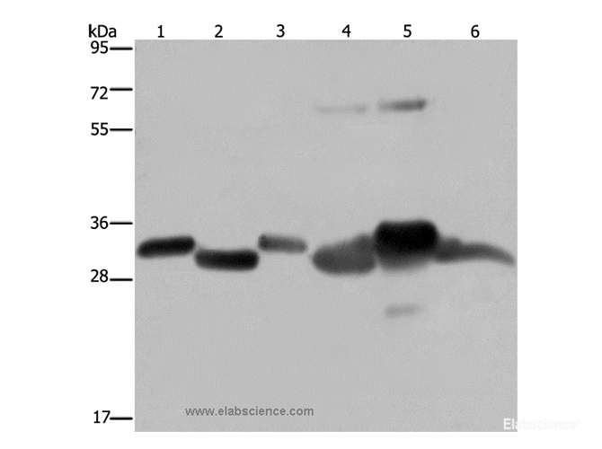 Western Blot analysis of Mouse thymus and Human ovarian cancer tissue, Mouse heart, Human fetal liver, Mouse liver tissue and SKOV3 cell   using HMGCL Polyclonal Antibody at dilution of 1:300