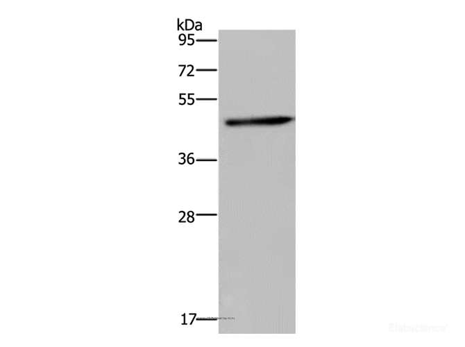 Western Blot analysis of Mouse brain tissue using HOMER1 Polyclonal Antibody at dilution of 1:300