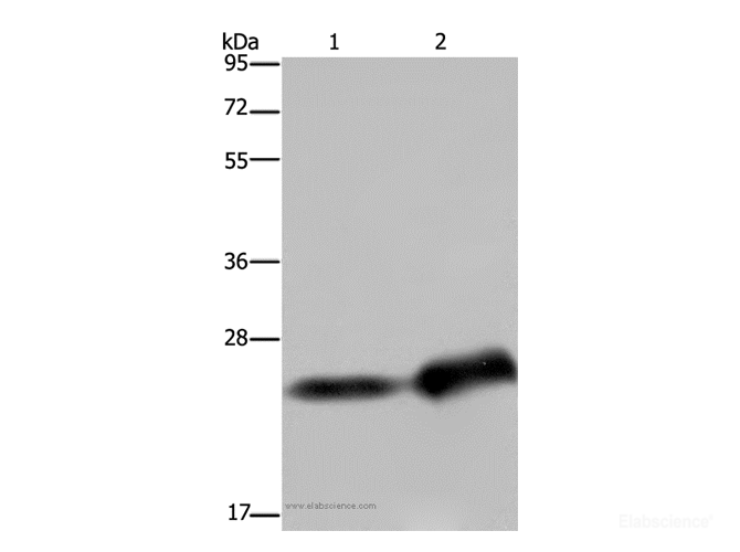 Western Blot analysis of Human breast infiltRative duct and placenta tissue using CSH1 Polyclonal Antibody at dilution of 1:300