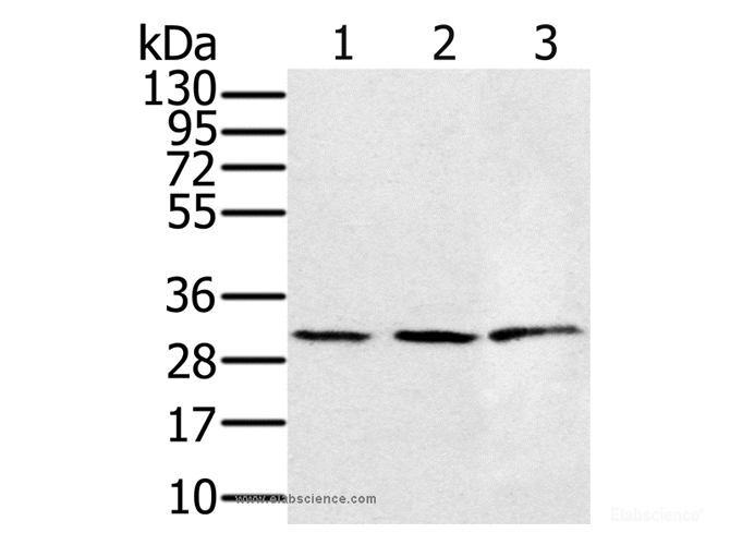 Western Blot analysis of 293T and K562 cell,  Human fetal liver tissue using HSD17B8 Polyclonal Antibody at dilution of 1:450