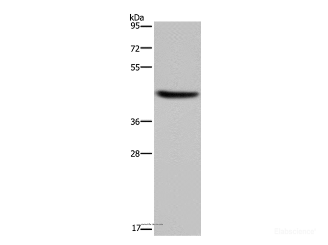 Western Blot analysis of Human adrenal gland tissue using HSD3B1 Polyclonal Antibody at dilution of 1:250