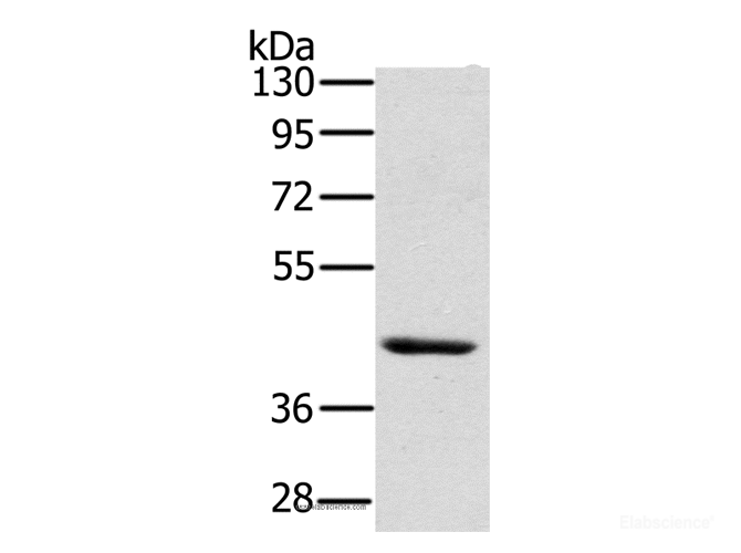 Western Blot analysis of Skov3 cell using HSD3B7 Polyclonal Antibody at dilution of 1:400