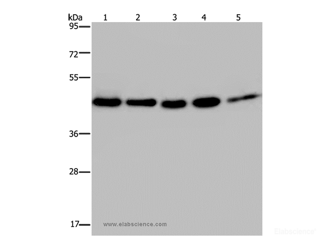 Western Blot analysis of 231, A431, Raji, Jurkat and HepG2 cell using HSP40-4 Polyclonal Antibody at dilution of 1:500