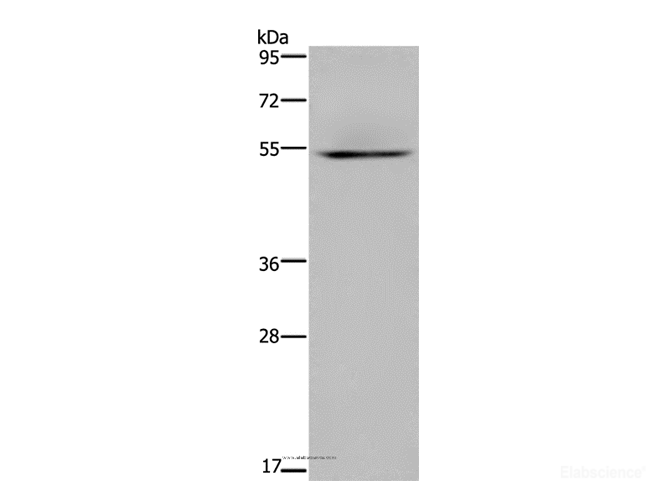 Western Blot analysis of Human kidney tissue using HYAL3 Polyclonal Antibody at dilution of 1:400