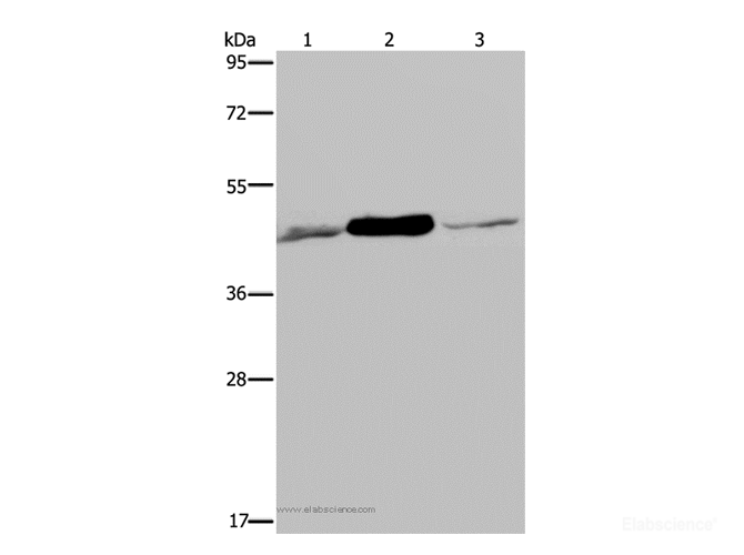 Western Blot analysis of 293T and Jurkat cell, Human fetal muscle tissue using IDH2 Polyclonal Antibody at dilution of 1:600