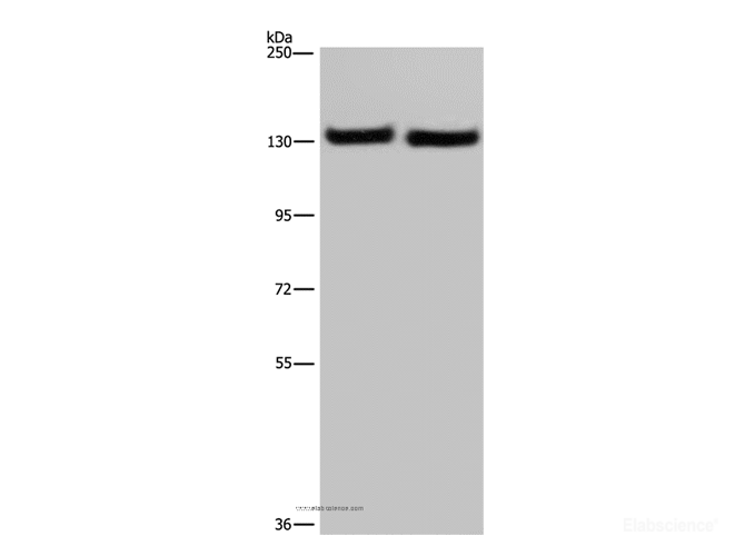 Western Blot analysis of A549 cell and Human testis tissue using IPO4 Polyclonal Antibody at dilution of 1:550