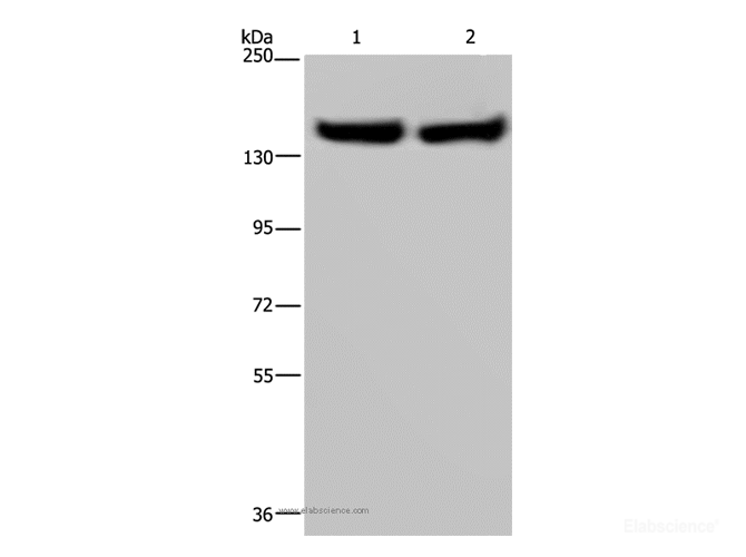 Western Blot analysis of Human placenta and fetal liver tissue using ITGA2B Polyclonal Antibody at dilution of 1:650
