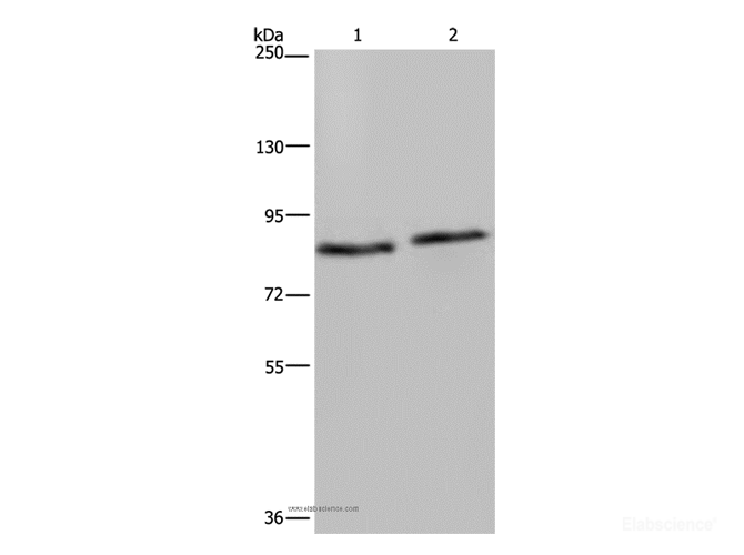 Western Blot analysis of 293T and K562 cell using ITGB2 Polyclonal Antibody at dilution of 1:600