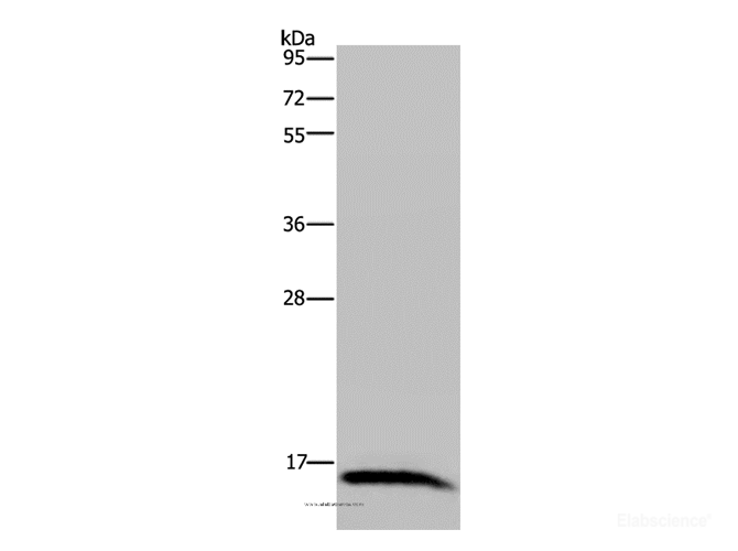 Western Blot analysis of Human hepatocellular carcinoma tissue using IRGM Polyclonal Antibody at dilution of 1:200