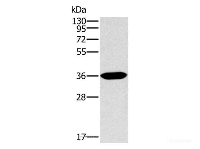 Western Blot analysis of Human fetal intestine tissue using ITLN1 Polyclonal Antibody at dilution of 1:400