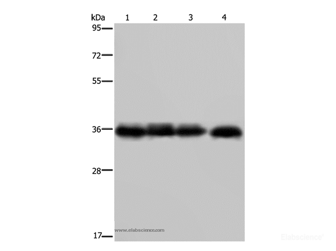 Western Blot analysis of K562 cell and Human kidney cancer tissue, 293T and HepG2 cell using JAM-A Polyclonal Antibody at dilution of 1:600