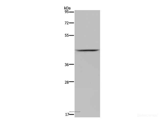 Western Blot analysis of Mouse liver tissue using JMJD6 Polyclonal Antibody at dilution of 1:800