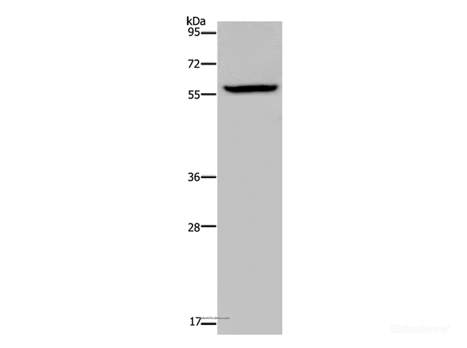 Western Blot analysis of Human fetal brain tissue using KDM4D Polyclonal Antibody at dilution of 1:1100