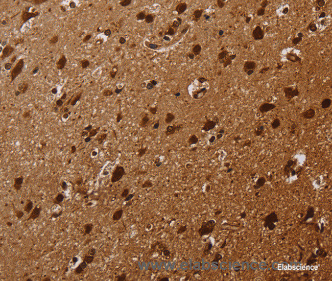 Immunohistochemistry of paraffin-embedded Human brain tissue using KARS Polyclonal Antibody at dilution 1:30