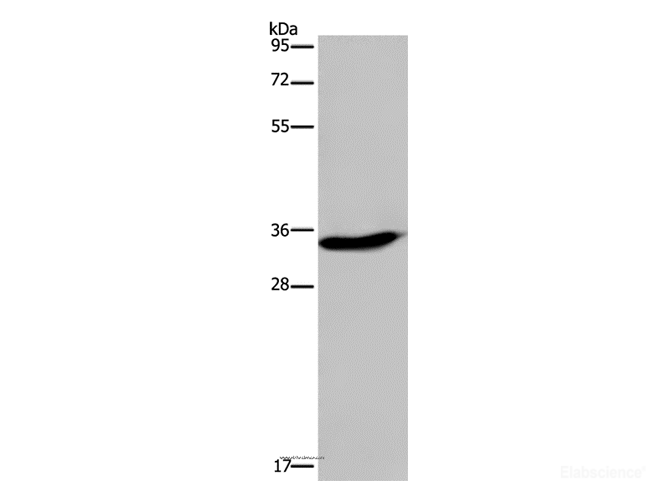 Western Blot analysis of A375 cell using KLK6 Polyclonal Antibody at dilution of 1:300