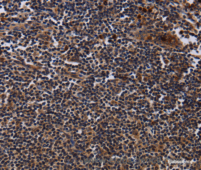 Immunohistochemistry of paraffin-embedded Human tonsil tissue using NTMT1 Polyclonal Antibody at dilution 1:40