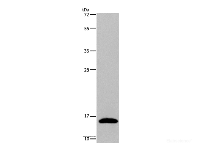 Western Blot analysis of Mouse pancreas tissue using REG3G Polyclonal Antibody at dilution of 1:400