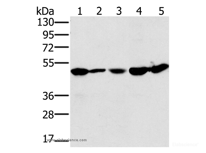 Western Blot analysis of 231 and Jurkat cell, Mouse liver tissue, 293T and hela cell using PSMC2 Polyclonal Antibody at dilution of 1:400