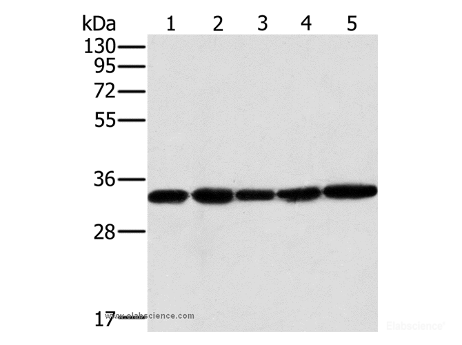 Western Blot analysis of Human testis tissue and K562 cell, PC3 cell and Human liver cancer tissue, hela cell using MTCH2 Polyclonal Antibody at dilution of 1:400