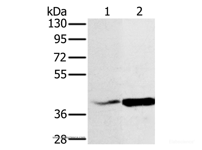 Western Blot analysis of Hela and A549 cell using NDUFA10 Polyclonal Antibody at dilution of 1:500