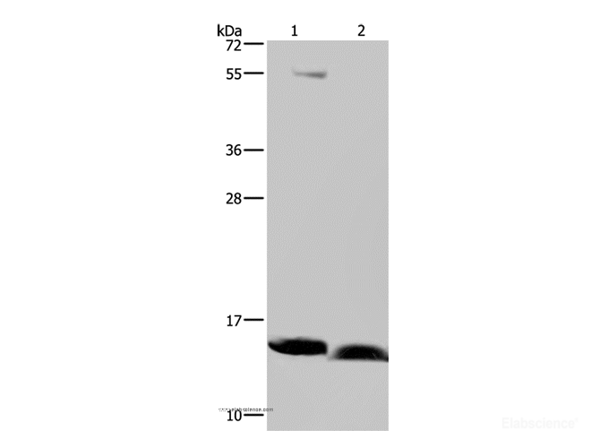 Western Blot analysis of Human bladder carcinoma and fetal brain tissue using NDUFA5 Polyclonal Antibody at dilution of 1:400