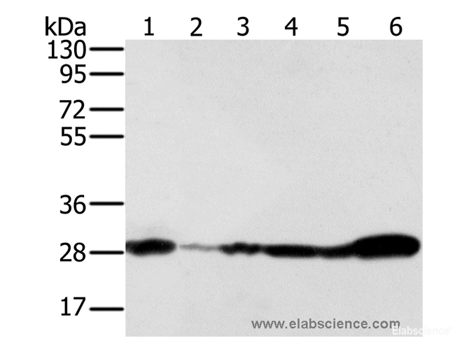 Western Blot analysis of 293T, NIH/3T3, Raw264.7 and hela cell, Human fetal brain and Mouse brain tissue using NDUFS3 Polyclonal Antibody at dilution of 1:350