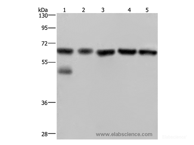 Western Blot analysis of Jurkat cell and Human brain malignant glioma tissue, PC3, K562 and A549 cell using NUP62 Polyclonal Antibody at dilution of 1:300