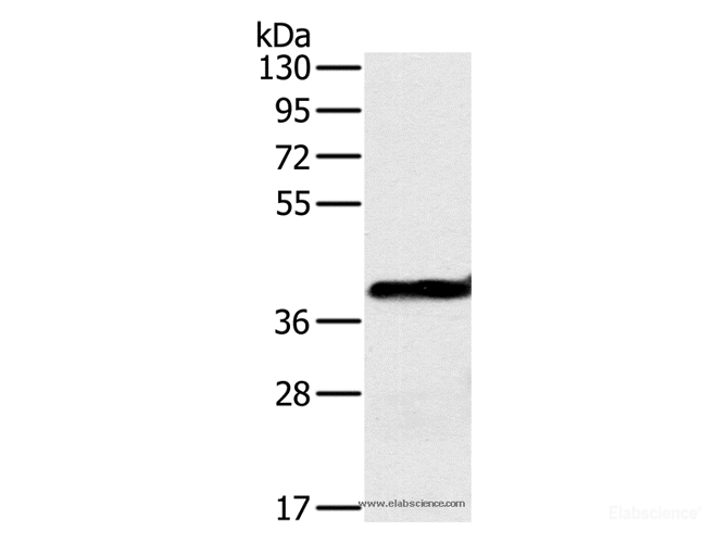 Western Blot analysis of Mouse liver tissue using OTC Polyclonal Antibody at dilution of 1:650