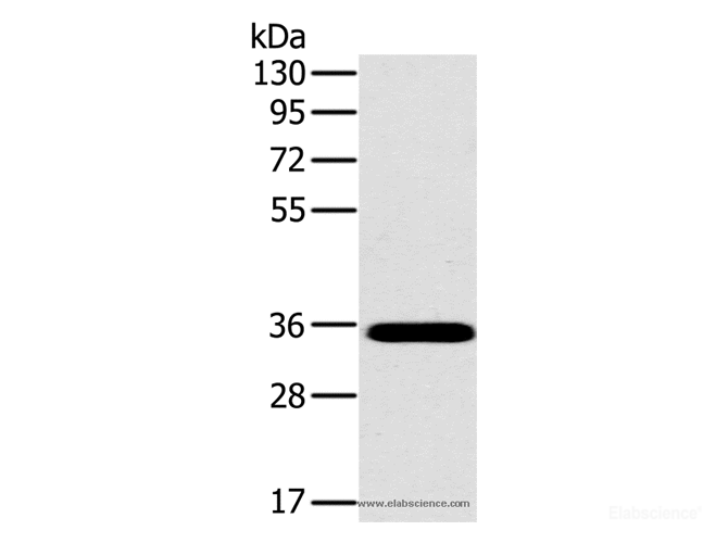Western Blot analysis of Mouse brain tissue using OTUB1 Polyclonal Antibody at dilution of 1:800