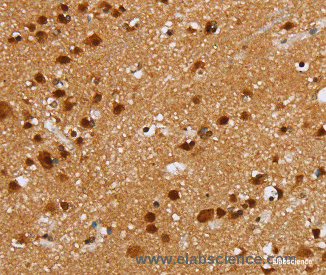 Immunohistochemistry of paraffin-embedded Human brain tissue using ZMAT3 Polyclonal Antibody at dilution 1:30