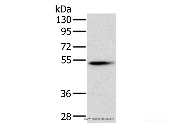 Western Blot analysis of Mouse pancreas tissue using PNLIP Polyclonal Antibody at dilution of 1:400
