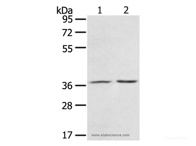 Western Blot analysis of Mouse stomach tissue and A431 cell using PDLIM4 Polyclonal Antibody at dilution of 1:800