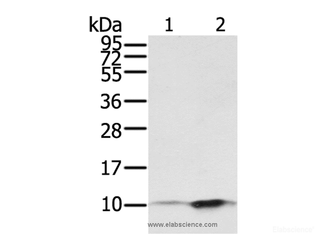 Western Blot analysis of A431 and hela cell using S100P Polyclonal Antibody at dilution of 1:650