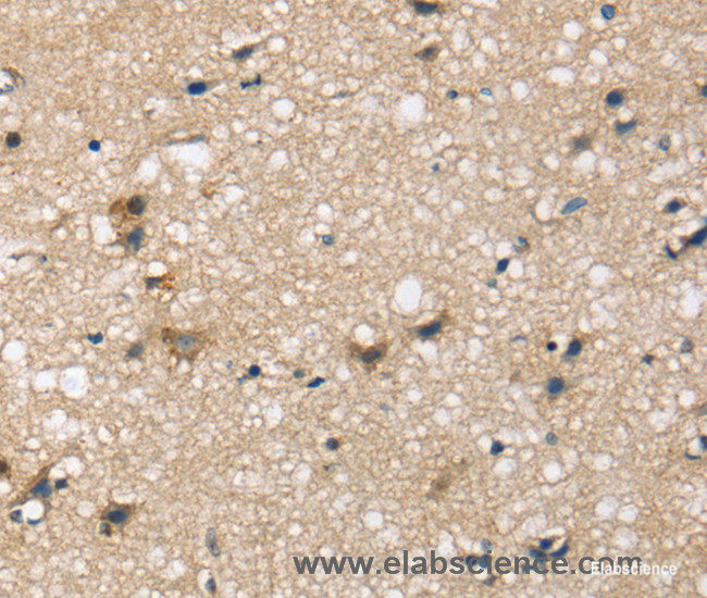 Immunohistochemistry of paraffin-embedded Human brain tissue using SEMA4A Polyclonal Antibody at dilution 1:45