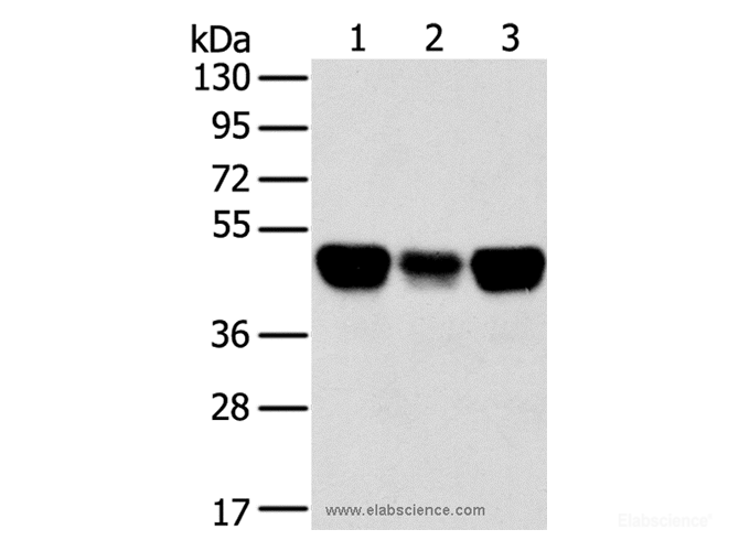 Western Blot analysis of Lovo, A549 and hela cell using TRIM21 Polyclonal Antibody at dilution of 1:400