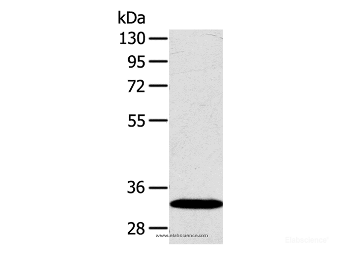 Western Blot analysis of Human fetal liver tissue using SULT2A1 Polyclonal Antibody at dilution of 1:650